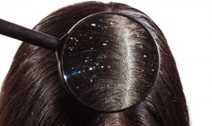 Rambut Ketombean